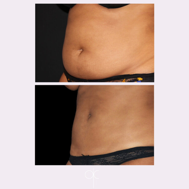 Docteur Claude avant après