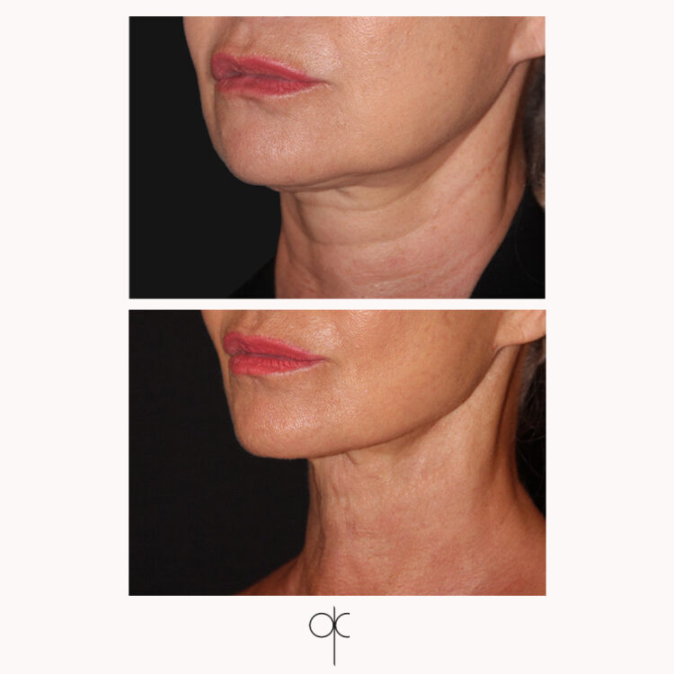 Docteur Claude avant après