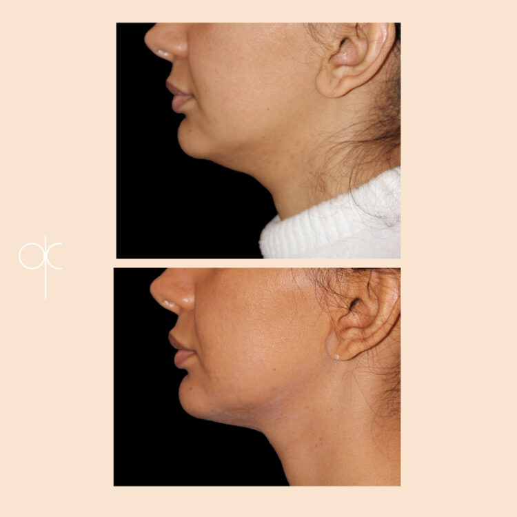 Docteur Claude avant après