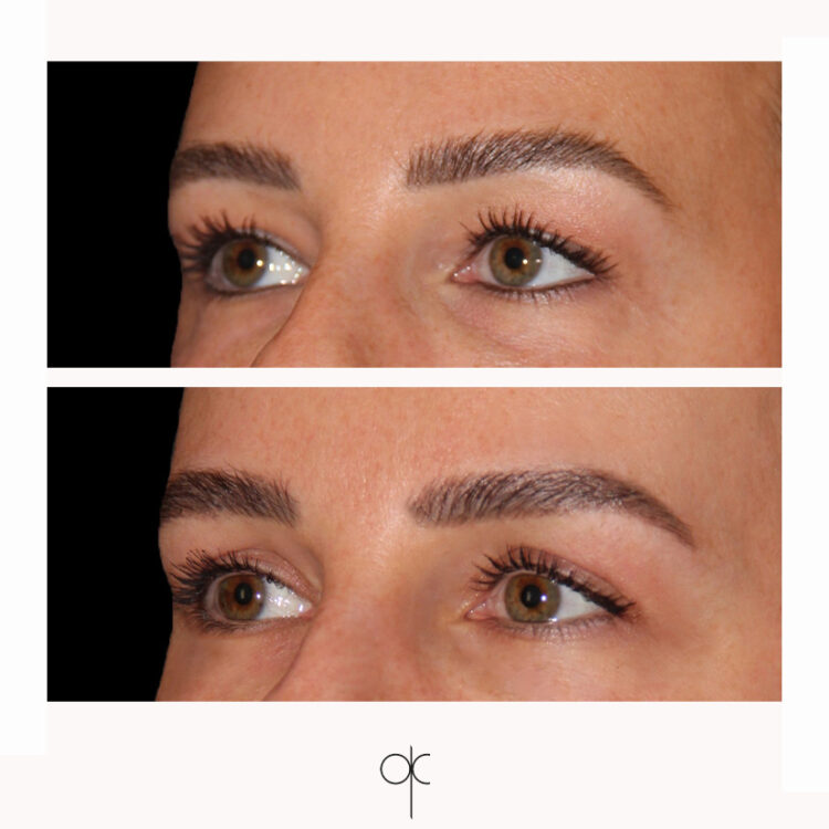 Docteur Claude avant après