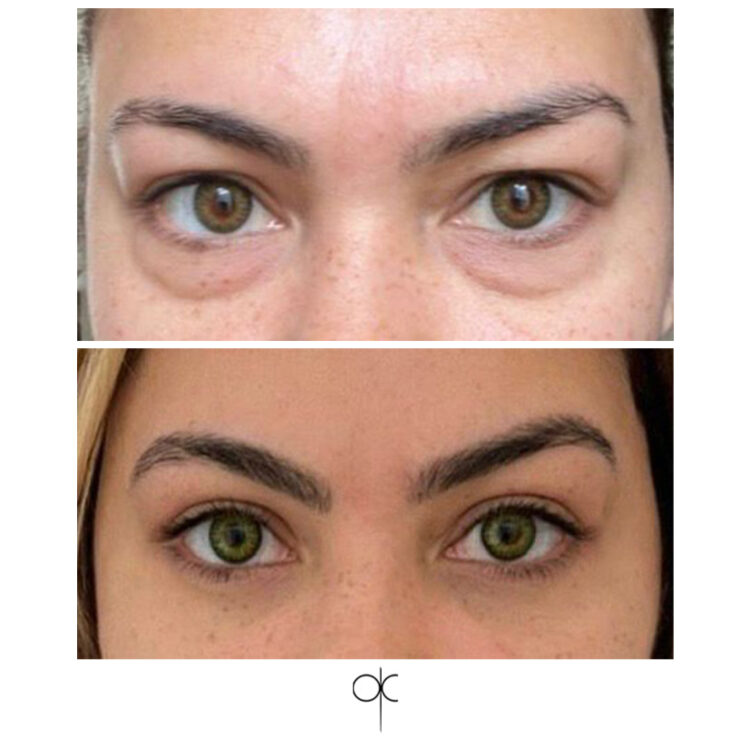 Docteur Claude avant après