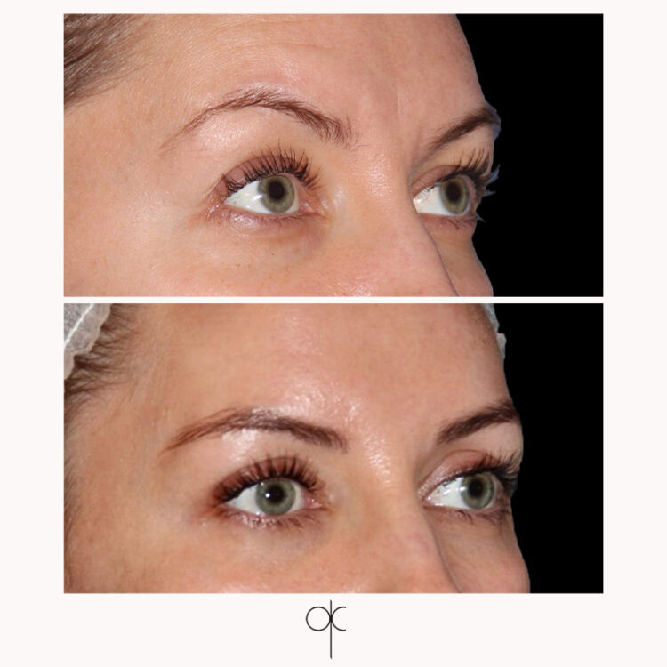 Docteur Claude avant après