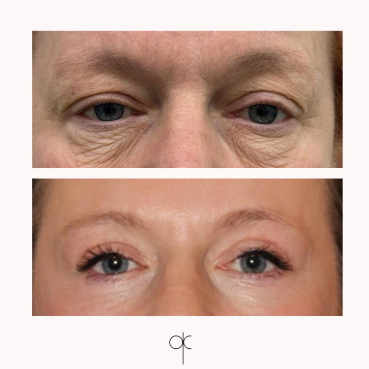 Docteur Claude avant après