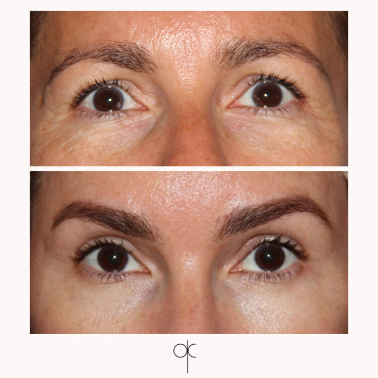 Docteur Claude avant après