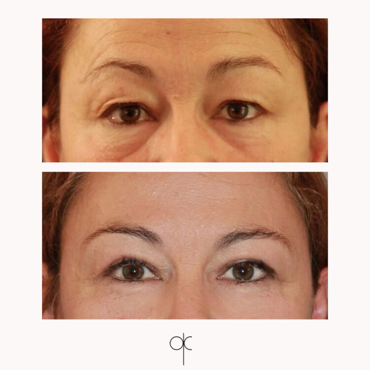 Docteur Claude avant après