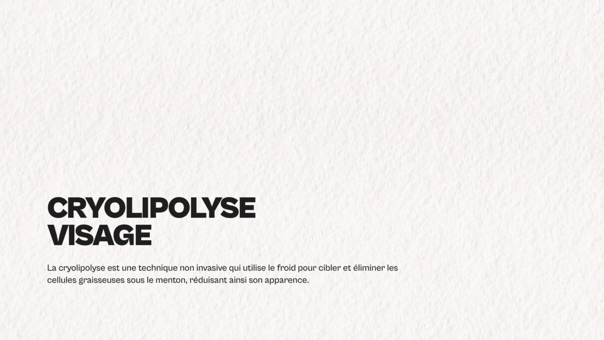 Dr-Claude-Video-Cryolipolyse